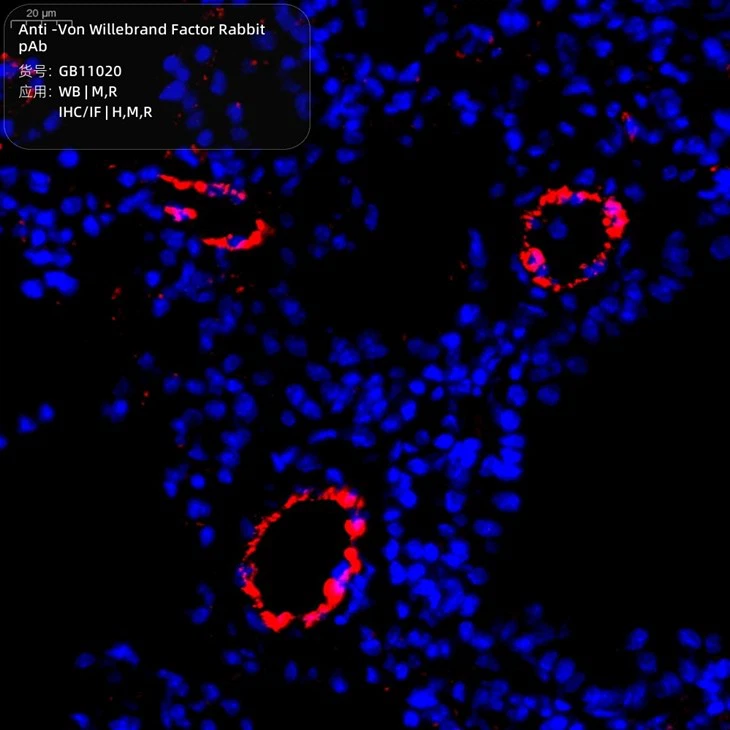 GB11020-100-3 Anti-Von Willebrand Factor Rabbit pAb