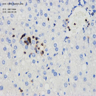 Anti-CD45 KABBIT PAB