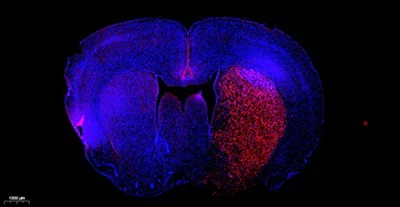 Sada pro detekci apoptózy buněk TMR (červená).